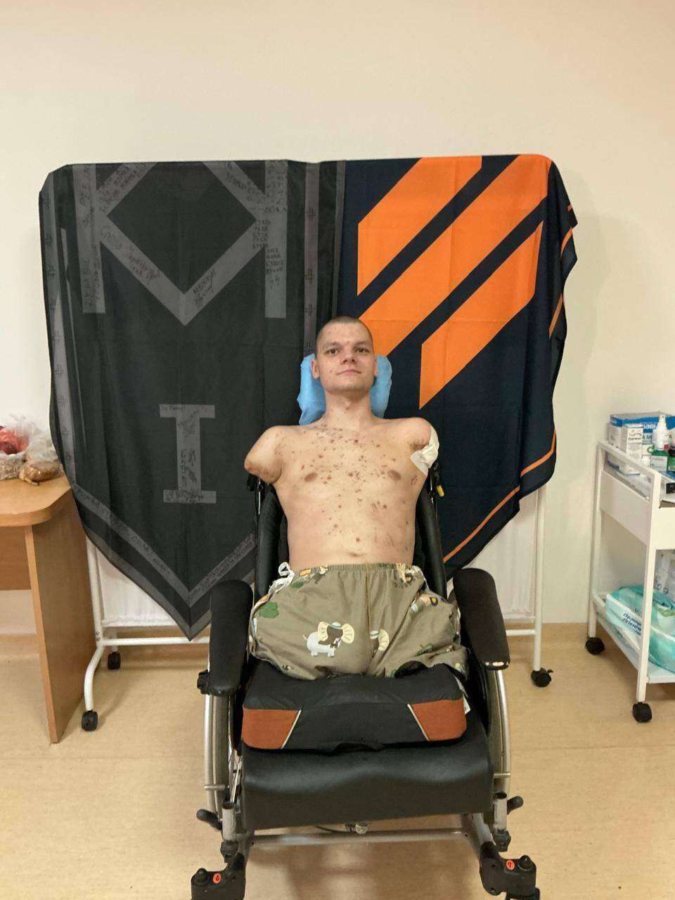 Скандал у ПриватБанку: військовий з ампутацією не зміг отримати картку через відсутність рук